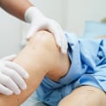 Expert Tips for a Successful Knee Replacement Surgery