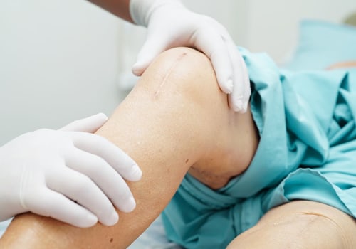 The Role of Anesthesia in Knee Replacement Surgery