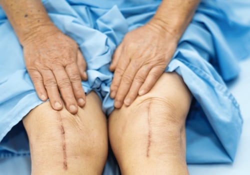 The Importance of Follow-Up Appointments After Knee Replacement Surgery