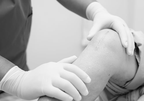 Expert Tips for a Successful Knee Replacement Surgery